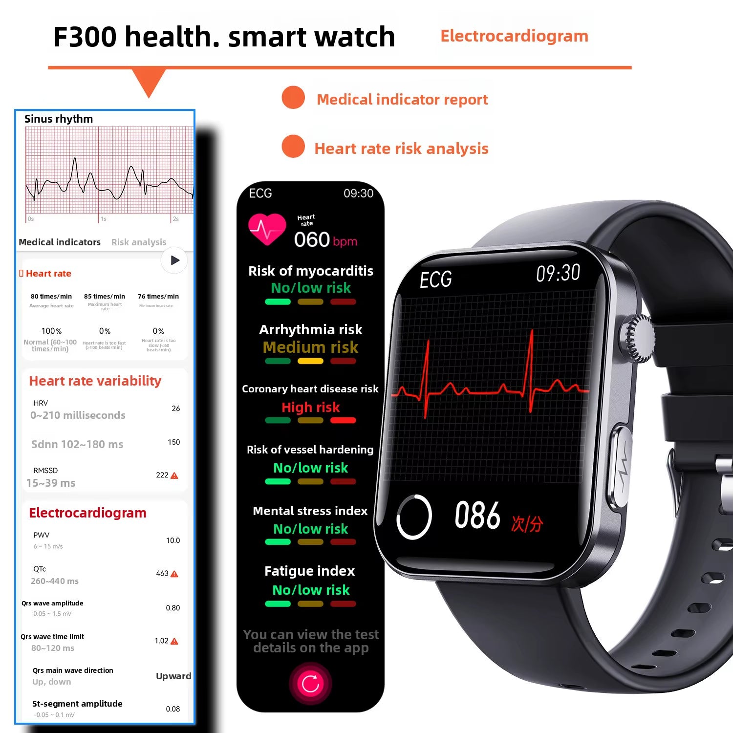 Discover the Mini F300 Smart Watch: Your Ultimate Companion for All-Day Heart Rate Monitoring, ECG Detection, and SOS Emergency Alerts with a Stunning Square Display